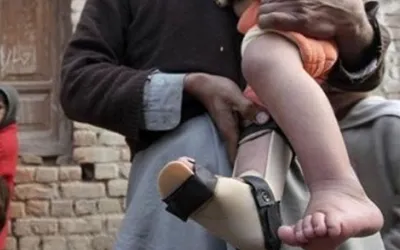 PMA concerned over reporting of polio case from Balochistan
