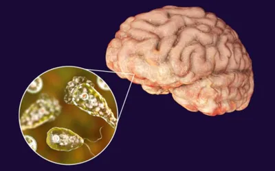 Naegleria Fowleri claims woman life in Karachi