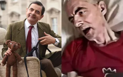 What to Know About the Viral 'Mr. Bean on Death Bed' Photo