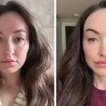 ‘Ferritin face’ goes viral as doctors warn against self-diagnosis