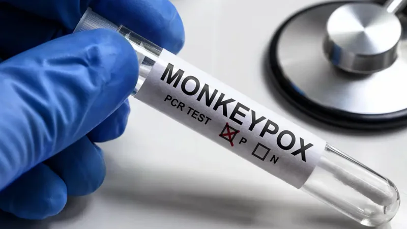 KP confirms third Monkeypox Case