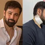 Emraan Hashmi sustains injuries while shooting for ‘Goodachari 2’