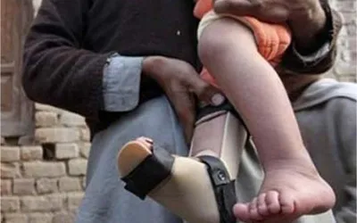 Three more polio cases reported in Pakistan