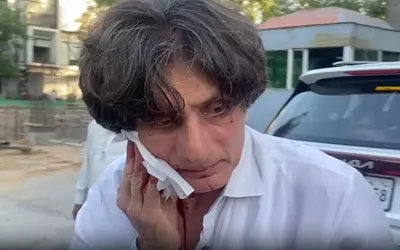 PTI leader Rauf Hassan injured in blade attack