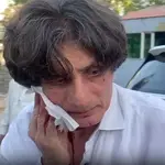 PTI leader Rauf Hassan injured in blade attack