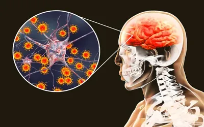 Encephalitis survivors face hidden mental health struggles