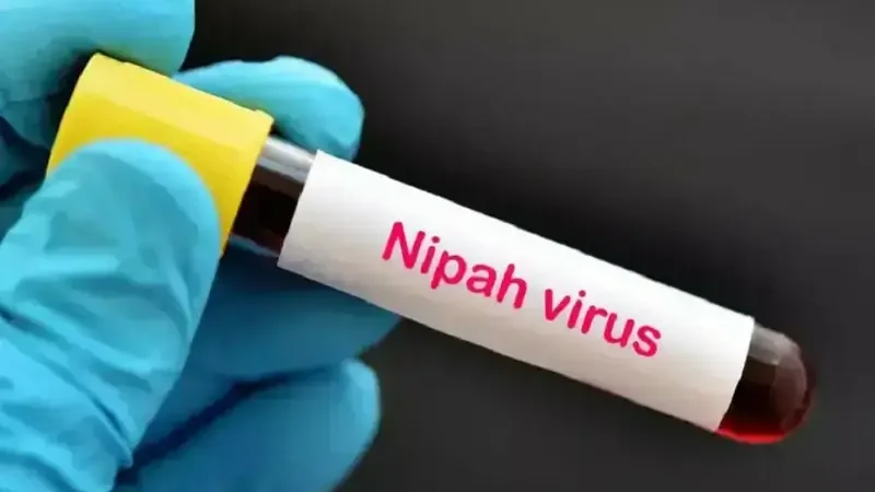 Nipah virus poses no immediate threat to Pakistan, say health experts