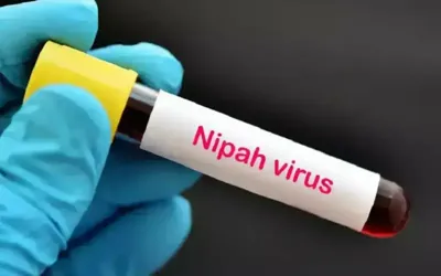 Nipah virus claims one life in Bangladesh: WHO