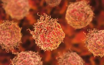 New drug trial offers hope for prostate cancer patients