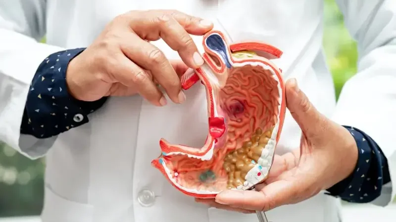 Stomach Cancer: Symptoms and Treatment