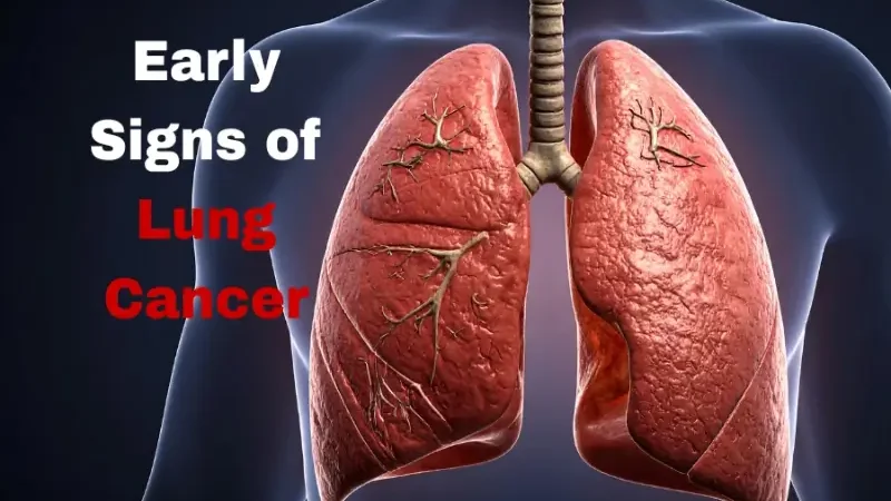 Five early signs of lung cancer