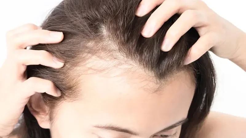 Five tips to care for thinning hair