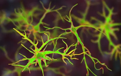 Single protein could play crucial role in fighting Alzheimer’s