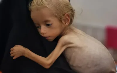 Starvation crisis in Gaza: 100 children dead amid Israel blockade