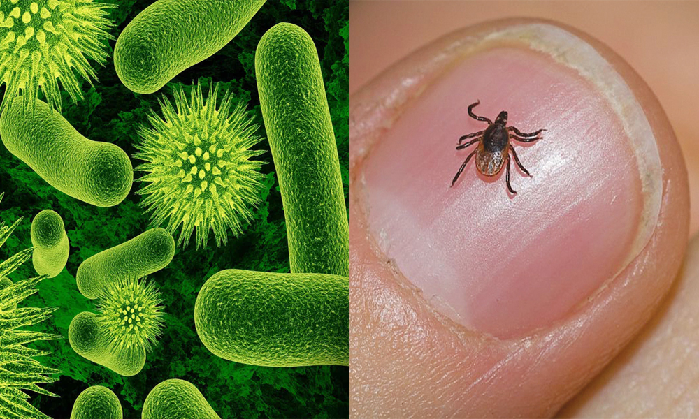 Congo virus killing people in Karachi