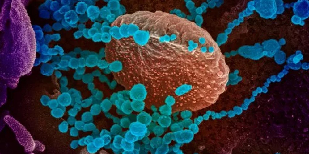 مزید 78 کیسز