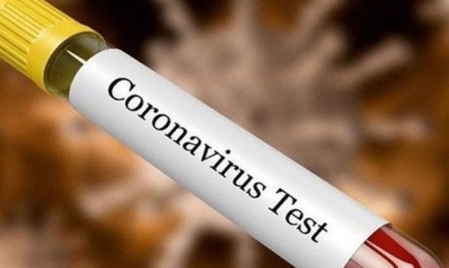 situation become worst in the world dua to Corona