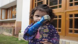 مصنوعی ہاتھ