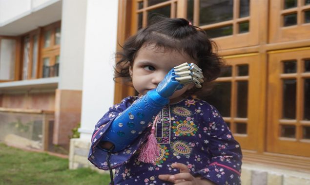 مصنوعی ہاتھ