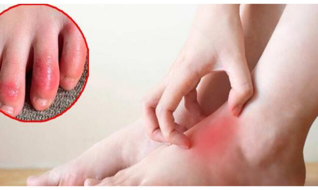 نئی چپّل یا موزوں