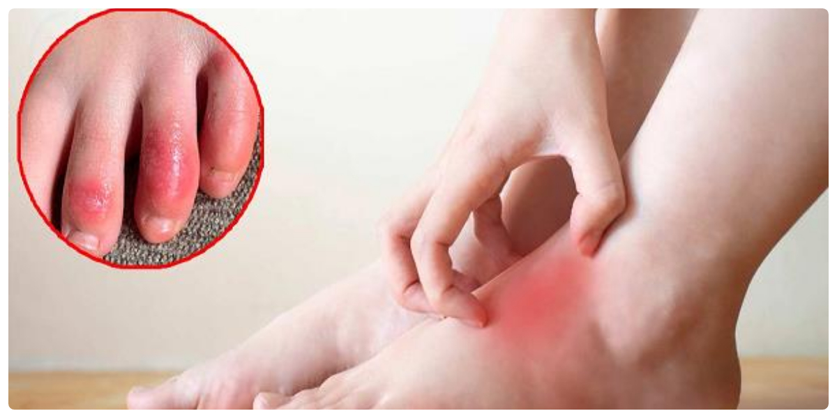 نئی چپّل یا موزوں