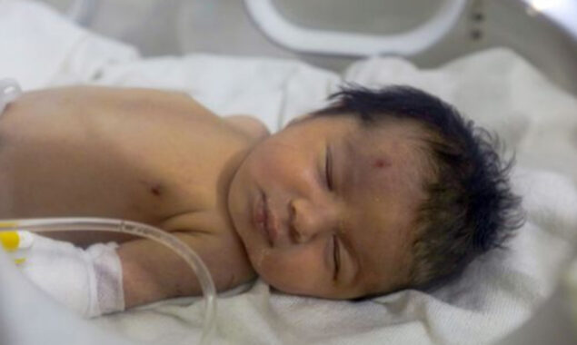 ملبے میں پیدا ہونے والی بچی کو بچانے والے نے گود لے لیا