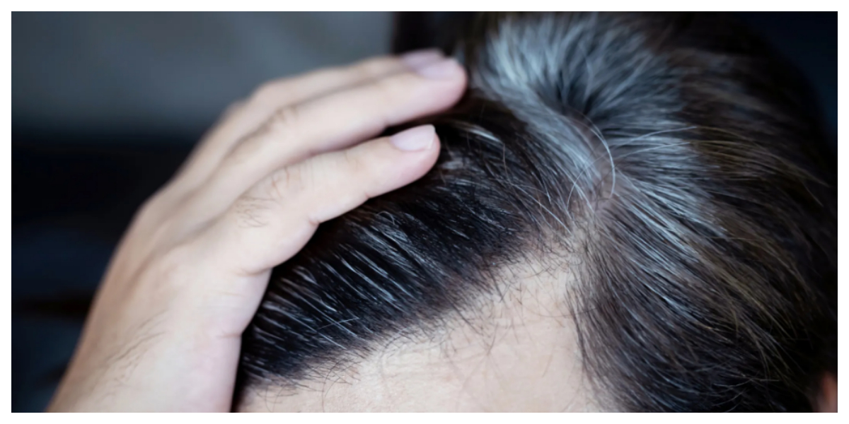 یہ 6 عوامل آپ کے بالوں کو وقت سے پہلے سفید کر سکتے ہیں