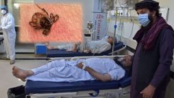 کانگو وائرس