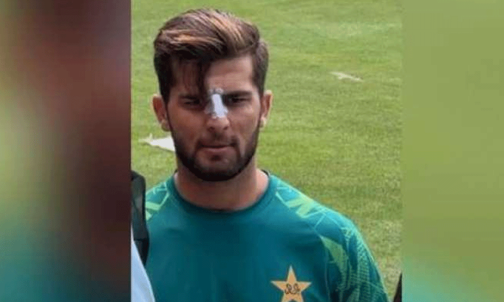 زخمی شاہین آفریدی کی وائرل ہونے والی تصویر کی حقیقت سامنے آگئی