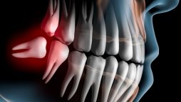 عقل داڑھ کیوں ہوتی ہے؟ ماہرین کا اہم انکشاف