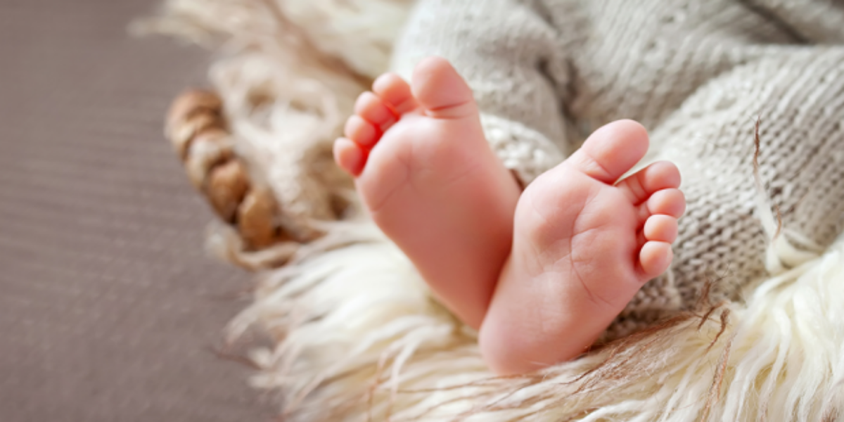 برازیل میں نایاب طبی حالت کے ساتھ بچی کی پیدائش