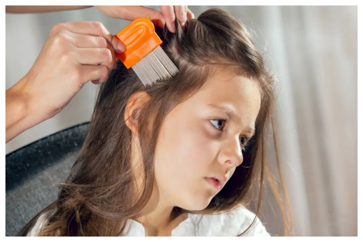 سر میں جوؤں کے خاتمے کے لیے کونسا طریقہ علاج مفید ثابت ہوتا ہے، ماہرین نے بتادیا؟