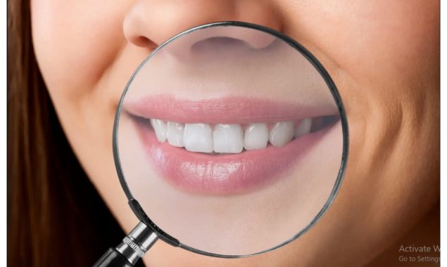 یہ عام غذائیں جو دانتوں کی سفیدی کو خراب کر سکتی ہیں