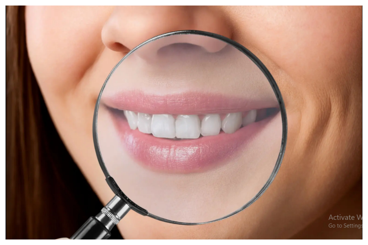 یہ عام غذائیں جو دانتوں کی سفیدی کو خراب کر سکتی ہیں