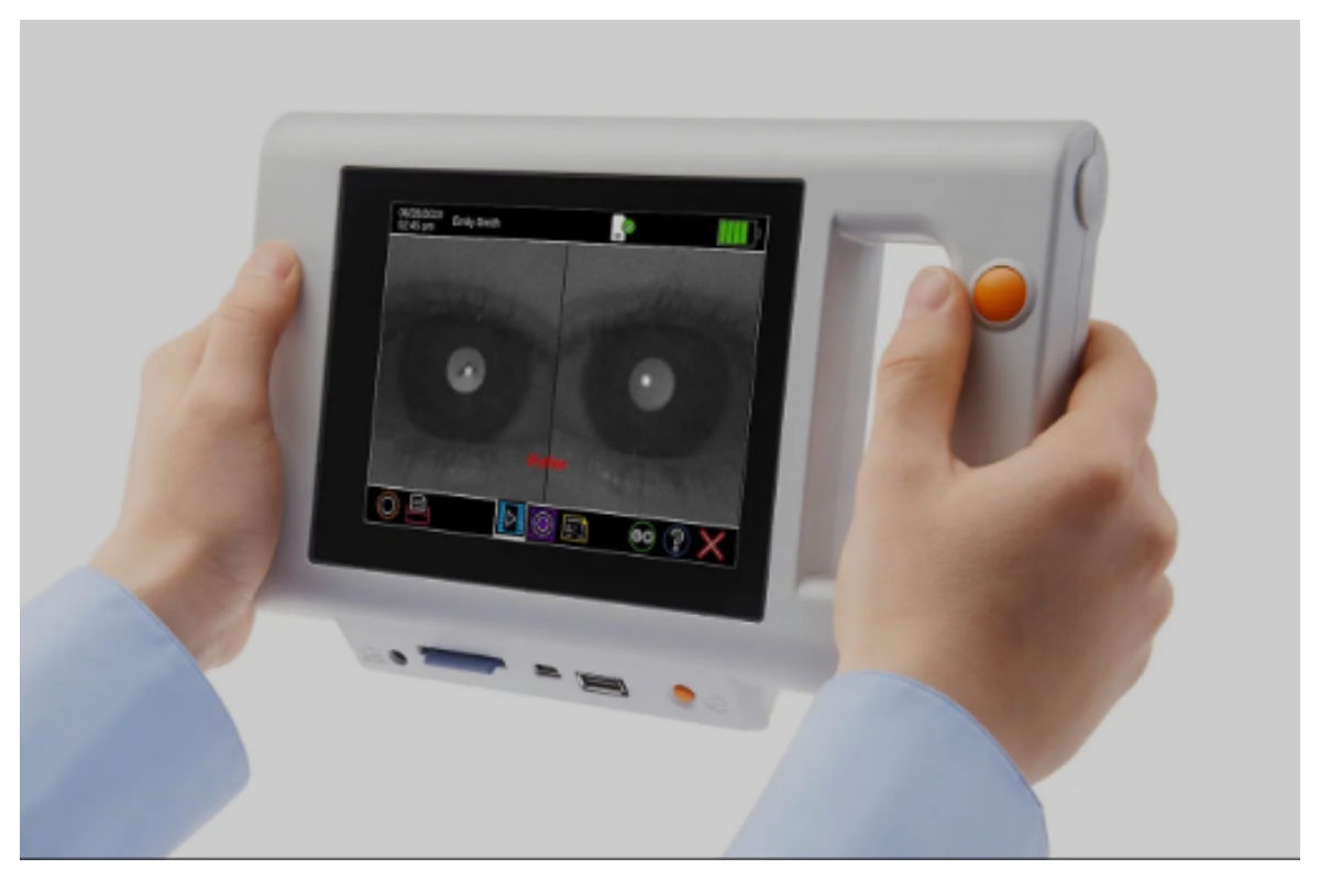 چیٹ جی پی ٹی نے ماہرِ امراضِ چشم کو پیچھے چھوڑ دیا