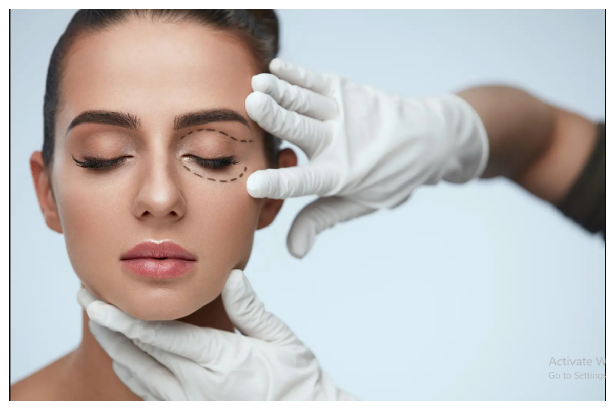 سیلفی کا رجحان لوگوں کو پلاسٹک سرجری کی طرف راغب کر رہا ہے، تحقیق