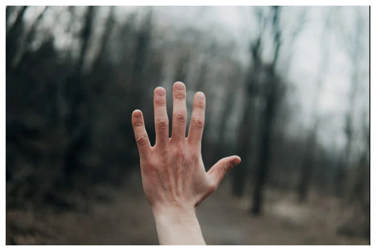 نایاب بیماری میں مبتلا شخص کا ڈاکٹر سے انوکھا اصرار