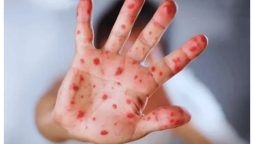 پنجاب میں خسرہ کے بڑھتے کیسز، صوبائی محکمہ صحت متحرک ہوگیا