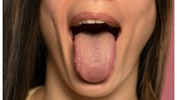صرف زبان دیکھ کر بیماری کی درست تشخیص کرنے والا اے آئی ماڈل تیار