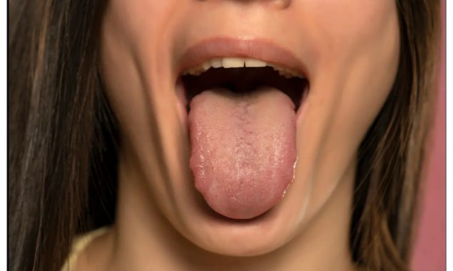 صرف زبان دیکھ کر بیماری کی درست تشخیص کرنے والا اے آئی ماڈل تیار