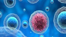 جوان افراد میں آنتوں یا معدے کا کینسر تیزی سے کیوں پھیلتا ہے؟ جانیئے