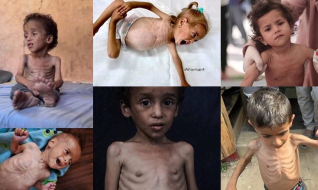 غزہ انسانی بحران کی انتہا پر: 40 ہزار نوزائیدہ بچوں کی زندگیاں خطرے میں، فلسطینی اتھارٹی کا انتباہ