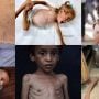 غزہ انسانی بحران کی انتہا پر: 40 ہزار نوزائیدہ بچوں کی زندگیاں خطرے میں، فلسطینی اتھارٹی کا انتباہ