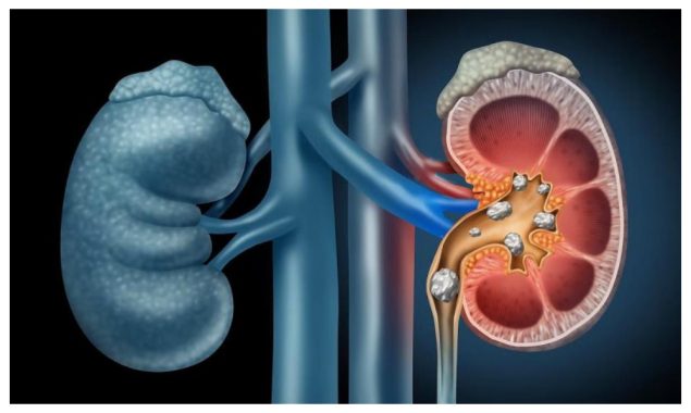 ملازمت کی کون سی شفٹ گردوں کی صحت کو متاثر کرتی ہے؟