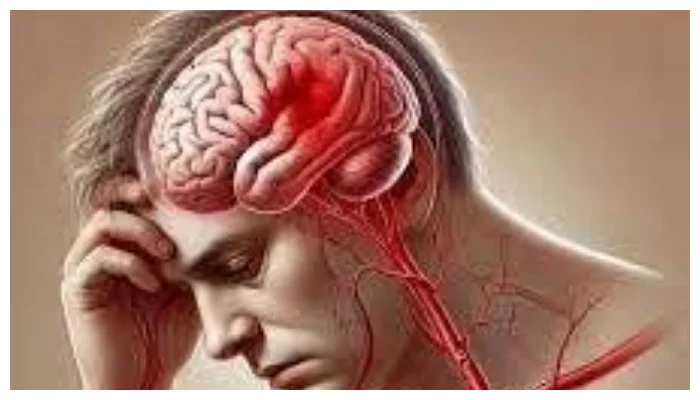 نوجوانوں میں فالج کے حملوں میں تشویشناک حد تک اضافہ ،ماہرین نے خبردار کر دیا