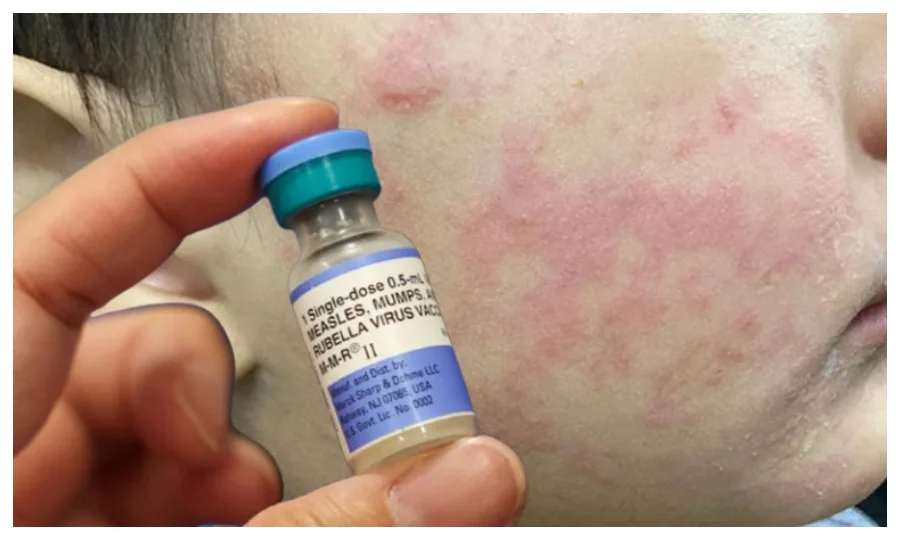 امریکی ریاست جنوبی کیرولینا میں خطرناک وبا نے سر اٹھا لیا