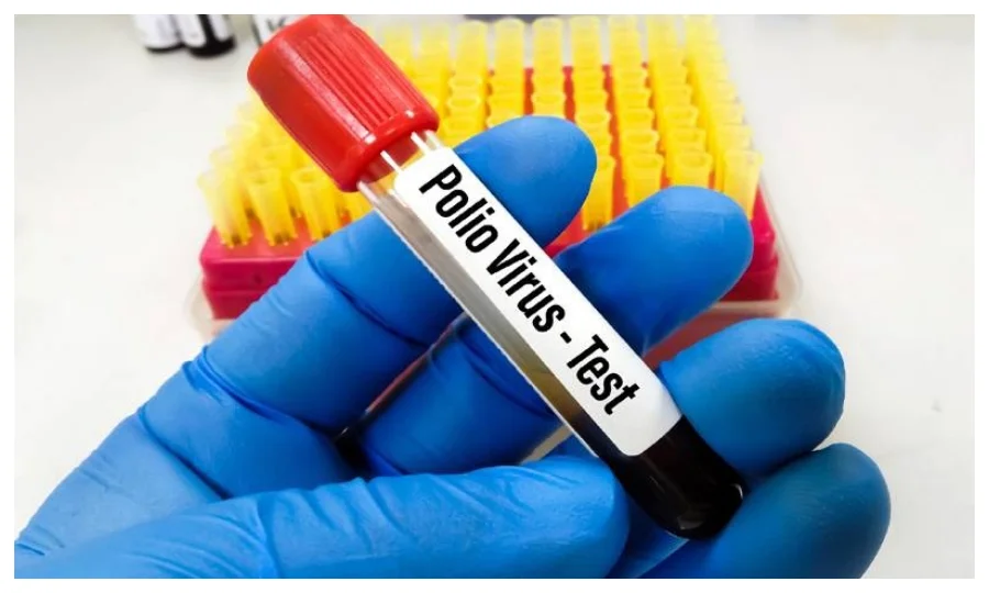پنجاب کے ماحولیاتی نمونوں میں پولیو وائرس کی موجودگی