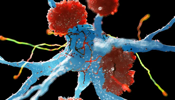 دماغ کے مدافعتی خلیات الزائمر بیماری کے خلاف حفاظتی کردار ادا کرسکتے ہیں، تحقیق