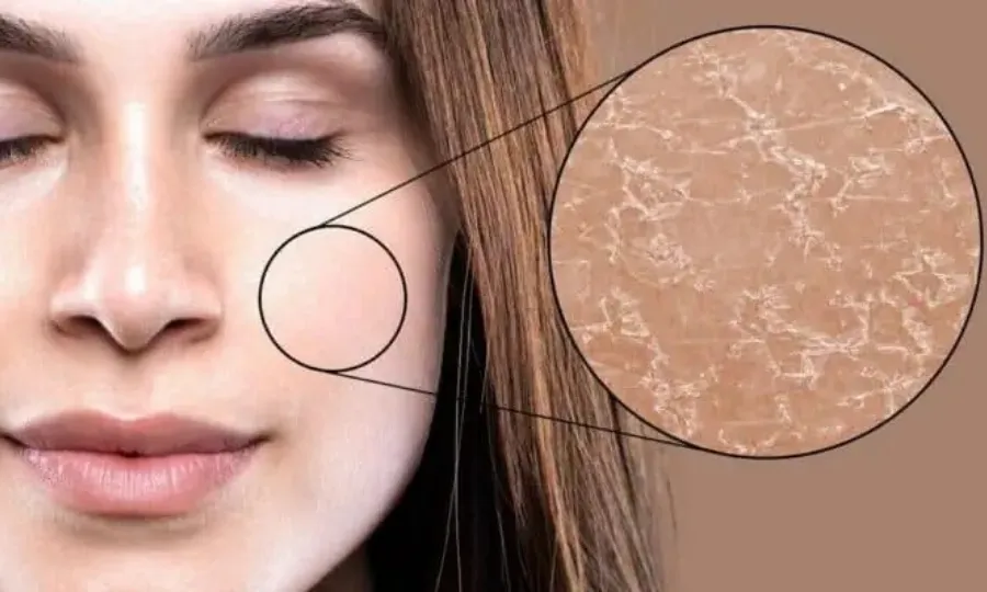 موسم سرما میں خشک جلد سے نجات کیلئے یہ قدرتی اجزاء آزمائیں