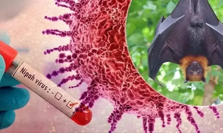 بھارت میں نِپاہ وائرس کے کیسز، سندھ میں ایڈوائزری جاری